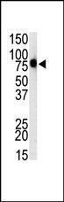 Anti-TLR1 Rabbit Polyclonal Antibody (HRP (Horseradish Peroxidase))