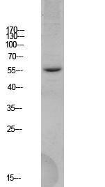 Anti-BACE antibody