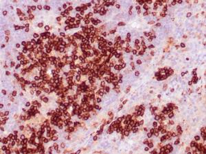 Immunohistochemical analysis of formalin-fixed, paraffin-embedded human tonsil using Anti-CD38 Antibody [CD38/4328]