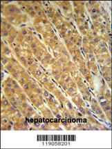 Anti-SF3B1 Rabbit Polyclonal Antibody