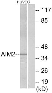 Western blot analysis of lysates from HUVEC cells using Anti-AIM2 Antibody. The right hand lane represents a negative control, where the antibody is blocked by the immunising peptide