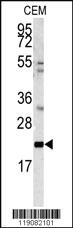 Anti-MGMT Rabbit Polyclonal Antibody