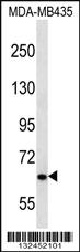 Anti-NPHP3 Rabbit Polyclonal Antibody