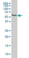 Anti-RALGPS2 Mouse Monoclonal Antibody [clone: 3F1]