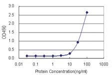 Anti-S100 A7 Antibody Pair