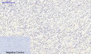 Immunohistochemical analysis of paraffin-embedded human uterus tissue using Anti-Smad3 (phospho Ser425) Antibody at 1:200 (4°C overnight). Negative control was secondary antibody only.