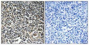 Immunohistochemical analysis of paraffin-embedded human thymus gland tissue using Anti-CBLN4 Antibody The right hand panel represents a negative control, where the antibody was pre-incubated with the immunising peptide