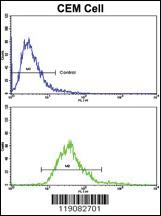 Anti-MGMT Rabbit Polyclonal Antibody