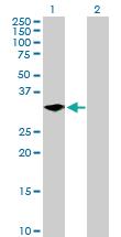 Anti-LYPD5 Mouse Polyclonal Antibody