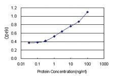 Anti-S100 A7 Polyclonal Antibody Pair