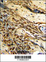 Anti-MGMT Rabbit Polyclonal Antibody