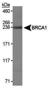 Anti-rRNA Mouse Monoclonal Antibody [clone: Y10b]