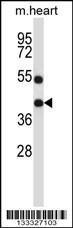 Anti-DTX3 Rabbit Polyclonal Antibody (FITC (Fluorescein Isothiocyanate))