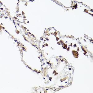 Immunohistochemistry analysis of paraffin-embedded human lung using Anti-Ferritin Heavy Chain Antibody [ARC2665] (A308297) at a dilution of 1:100 (40x lens)