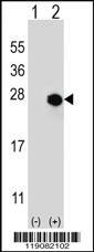 Anti-MGMT Rabbit Polyclonal Antibody