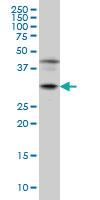 Anti-POU6F1 Mouse Monoclonal Antibody [clone: 6H1]