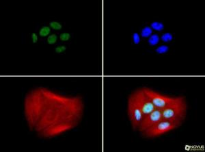 Anti-BRCA1 Mouse monoclonal antibody unconjugated [clone: RAY]