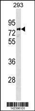 Anti-PARP6 Rabbit Polyclonal Antibody (AP (Alkaline Phosphatase))