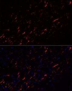 Anti-GFAP Rabbit Monoclonal Antibody [clone: ARC0206]