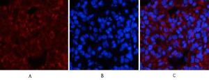 Immunofluorescence analysis of rat lung tissue using Anti-Smad3 (phospho Ser425) Antibody (red) at 1:200 (4°C overnight). Cy3 labelled secondary antibody was used at 1:300 (RT 50min). Panel A: Target. Panel B: DAPI. Panel C: Merge.