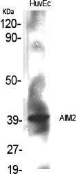 Western blot analysis of various cells using Anti-AIM2 Antibody