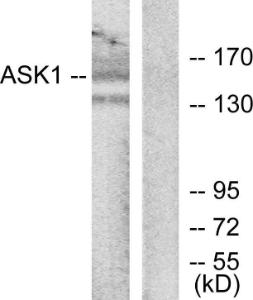 Antibody anti-ASK1 100 µg