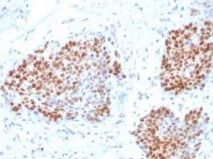 Immunohistochemical analysis of formalin-fixed, paraffin-embedded human pancreas using Anti-SOX9 Antibody [SOX9/3916R]