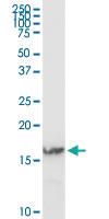 Anti-IFITM3 Rabbit Polyclonal Antibody