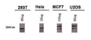 Anti-CTGF Rabbit Polyclonal Antibody