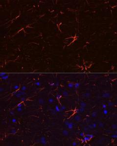 Anti-GFAP Rabbit Monoclonal Antibody [clone: ARC0206]