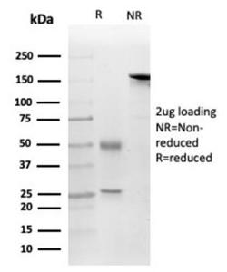 SDS-PAGE analysis of Anti-FGF23 Antibody [FGF23/4169] under non-reduced and reduced conditions; showing intact IgG and intact heavy and light chains, respectively. SDS-PAGE analysis confirms the integrity and purity of the antibody