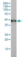 Anti-CK17 Mouse Monoclonal Antibody [clone: 2D4-1G9]