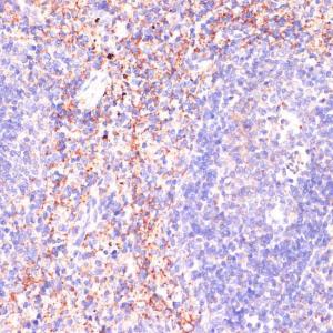 Immunohistochemistry analysis of paraffin-embedded mouse spleen using Anti-RAP1A Antibody (A12733) at a dilution of 1:100 (40X lens). Perform microwave antigen retrieval with 10 mM PBS buffer pH 7.2 before commencing with IHC staining protocol