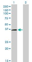 Anti-POU6F1 Mouse Monoclonal Antibody [clone: 6H1]