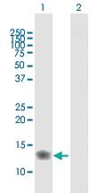 Anti-IFITM3 Rabbit Polyclonal Antibody