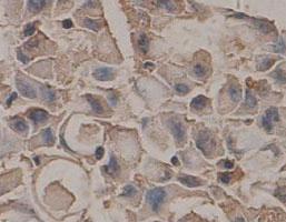 Anti-FASLG Rabbit Polyclonal Antibody