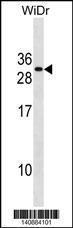 Anti-FADD Rabbit Polyclonal Antibody (HRP (Horseradish Peroxidase))