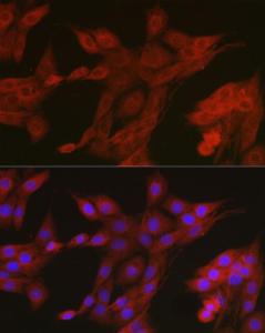 Immunofluorescence analysis of PC-12 cells using Anti-AMPK alpha 2 Antibody (A308298) at a dilution of 1:100 (40X lens). DAPI was used to stain the cell nuclei (blue)