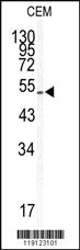 Anti-KLF5 Rabbit Polyclonal Antibody