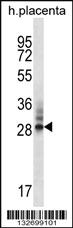 Anti-DNAJC27 Rabbit Polyclonal Antibody