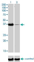 Anti-POU6F1 Mouse Monoclonal Antibody [clone: 6H1]