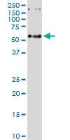 Anti-ABCC11 Rabbit Polyclonal Antibody