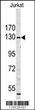 Anti-MYO1A Rabbit Polyclonal Antibody