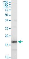 Anti-IFITM3 Rabbit Polyclonal Antibody