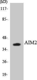 Anti-AIM2 antibody