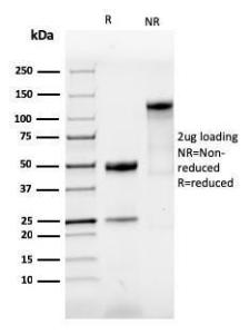 SDS-PAGE analysis of Anti-SOX9 Antibody [SOX9/3916R] under non-reduced and reduced conditions; showing intact IgG and intact heavy and light chains, respectively. SDS-PAGE analysis confirms the integrity and purity of the antibody