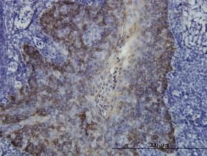 Anti-CK17 Mouse Monoclonal Antibody [clone: 2D4-1G9]