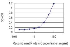 Anti-LYPD5 Mouse Monoclonal Antibody [clone: 1E9]