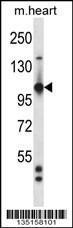 Anti-TIE1 Rabbit Polyclonal Antibody (PE (Phycoerythrin))