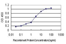 Anti-POU6F1 Mouse Monoclonal Antibody [clone: 6H1]